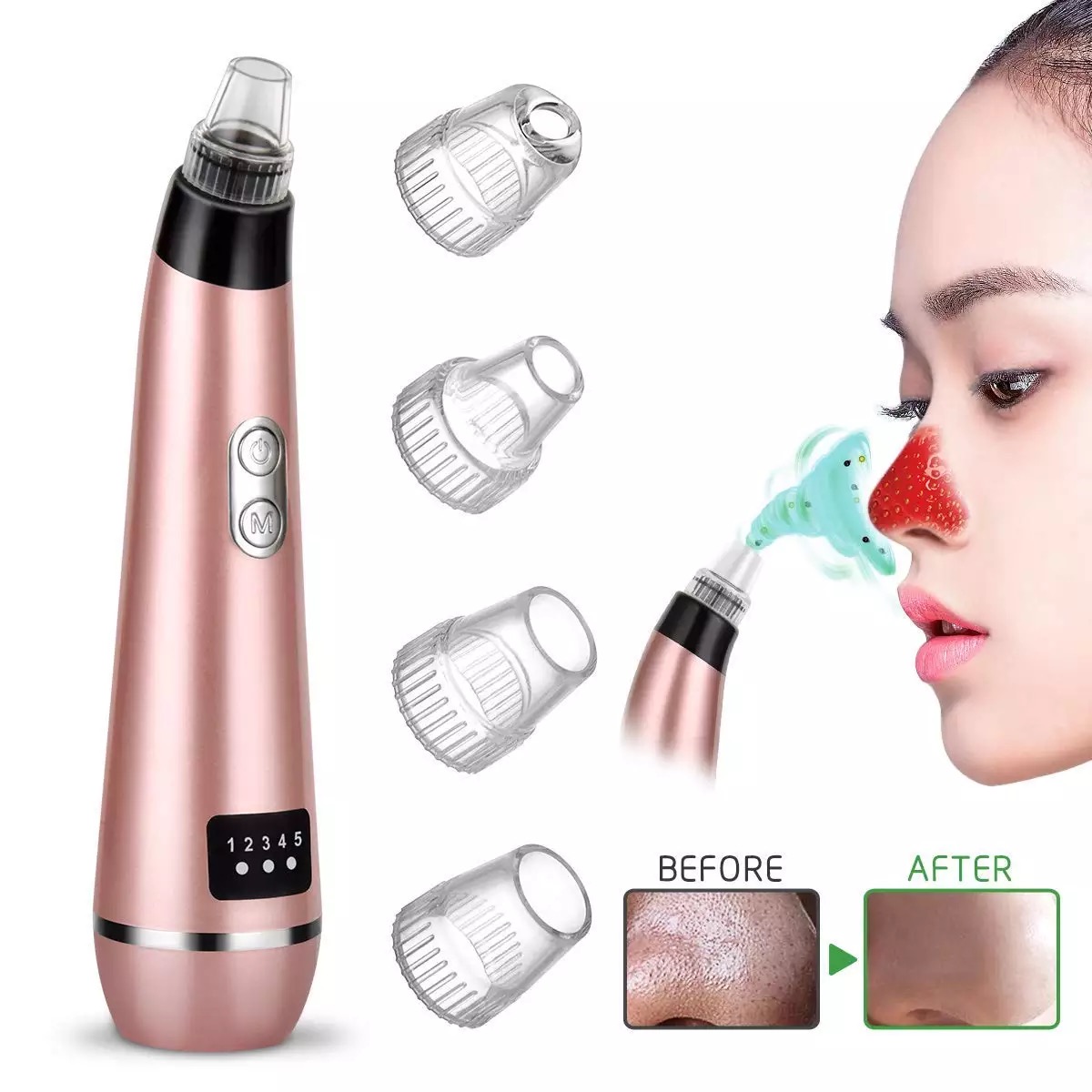 Blackhead Remover Acne Pore Cleaner Vacuum USB Rechargeable Color May Vary